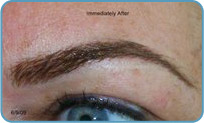 , Permanent Makeup Procedures Tampa