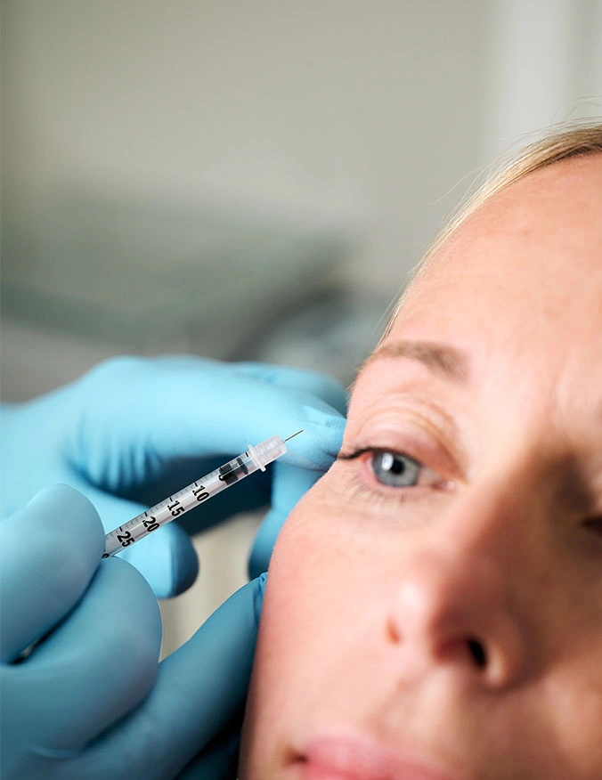 A close-up shot of a cosmetic injection being administered. A practitioner wearing blue gloves holds a small syringe with a fine needle near the outer corner of a patient's eye. The focus is sharp on the needle and the patient's eye, showing the precision of the wrinkle relaxer treatment. - Botox and Wrinkle Relaxers in Tampa, FL