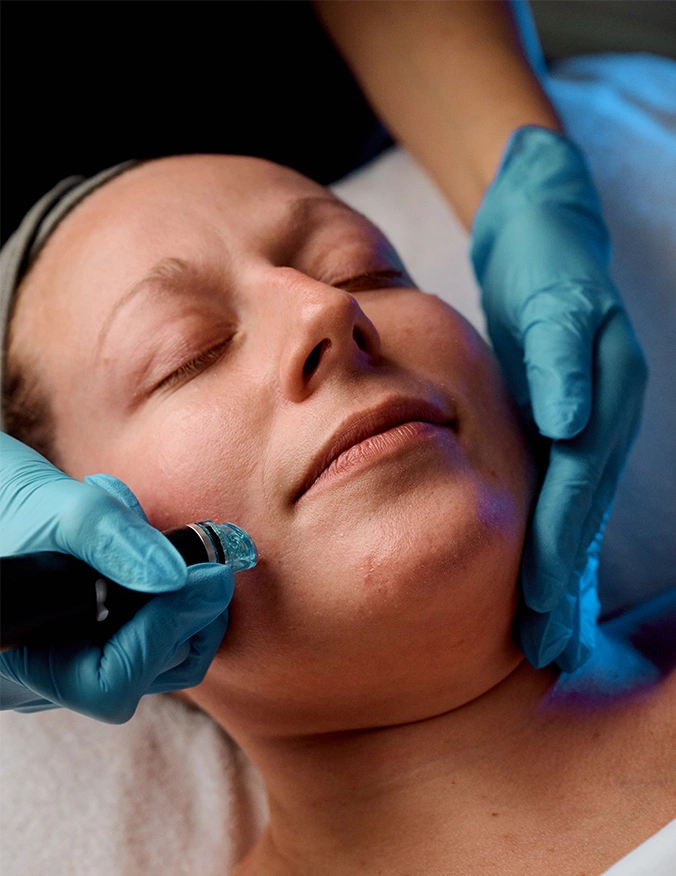 A close-up of a patient receiving a facial treatment. A practitioner in blue gloves uses a professional handheld device on the cheek area, while blue light therapy illuminates the patient's smooth, calm skin. - Microneedling in Tampa, FL